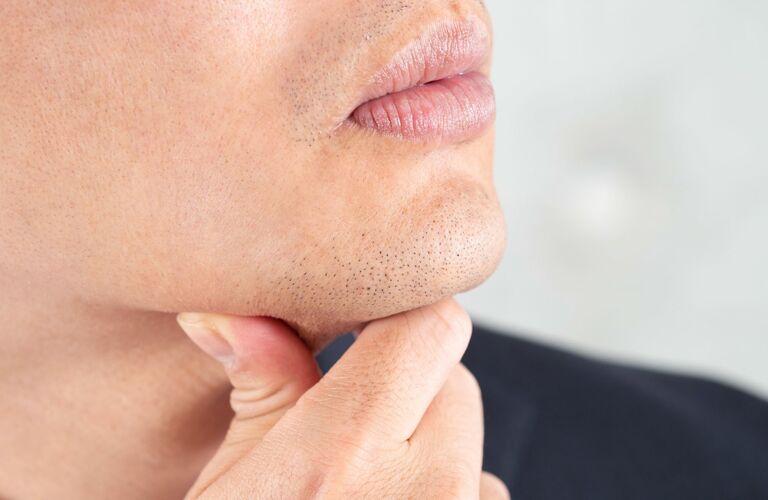顔をすっきりさせたい米子の男性向けのヒゲの脱毛 | 松江でメンズ脱毛なら都度払いで安心なメンズ脱毛サロンイッカ